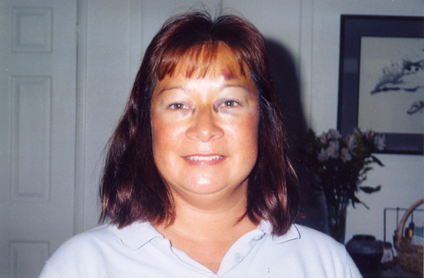 Terry-black-eyes-10-02